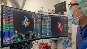RHYTHMIA HDx 3D Mapping System with Lumipoint, Directsense & MIFI Technology