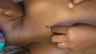 🔍 “Wait… What Is That on Your Back? 😳 | ASMR Nitpicking”