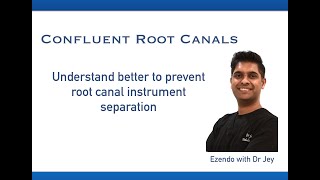 Confluent root canals