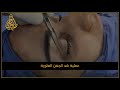 الدكتور طارق قبطي عملية شد الجفن العلوية الدكتور طارق قبطي عملية شد الجفن العلوية
