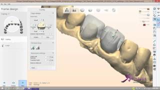 Celebrity Digital Multi-layered Centrals & CAD Blocks Design Profile