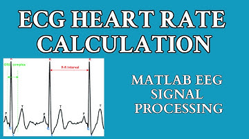 ECG Signal Processing using MATLAB | ECG Heart Rate Calculation | R-Peaks Detection!