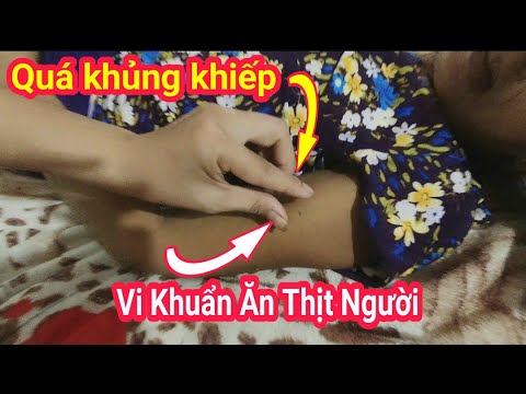 Video Quá Khủng Khi Thuận Phạm Chứng Kiến Cảnh. Vi Khuẩn Ăn... - youtube