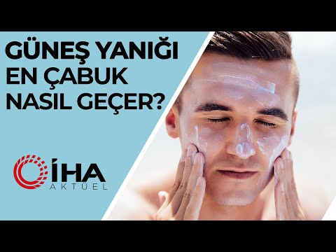 Video: Güneş Yanığı Sonrası Cilt Soyulmasını Nasıl Önlersiniz: 15 Adım