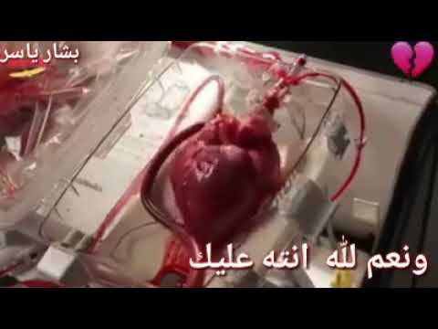 قلبي تعبان مجروح من كثر الشغل و الهموم