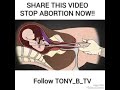JIEPUSHE NA ABORTION KAMA HIZI https://youtu.be/L9VPF6V1gig
