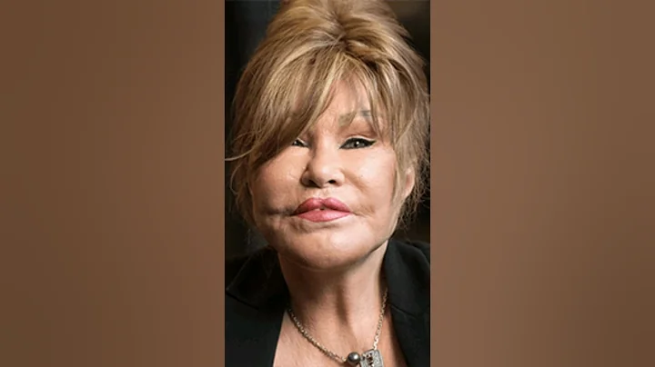 Catwoman' Jocelyn Wildenstein #shorts