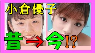 小倉優子 画像 のほくろ あご 背中からも消えた ホクロ除去跡があるか徹底調査 あさねた