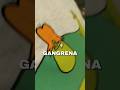 Terapia de #super y la banda gangrena. #caminarycrecer