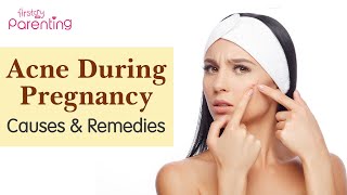 Acne During Pregnancy : Causes, Remedies and Prevention