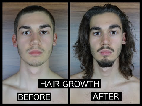 HAIR GROWTH TIME LAPSE - FRONT