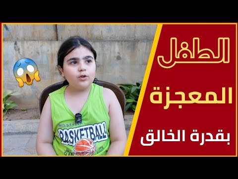 متلازمة الموهوب ومعجزة الله على الأرض تعرفوا على قصة ساري عزام