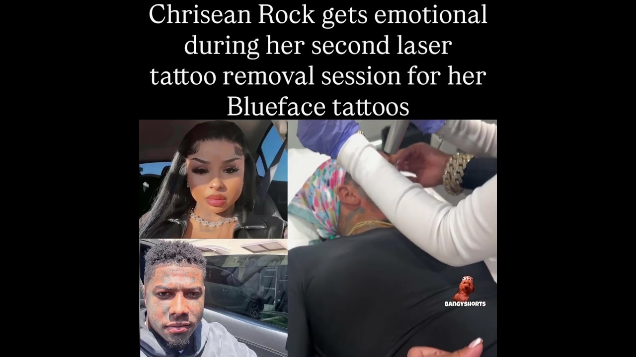 Chrisean Rock gets emotional during her second laser tattoo removal session for her Blueface tattoos