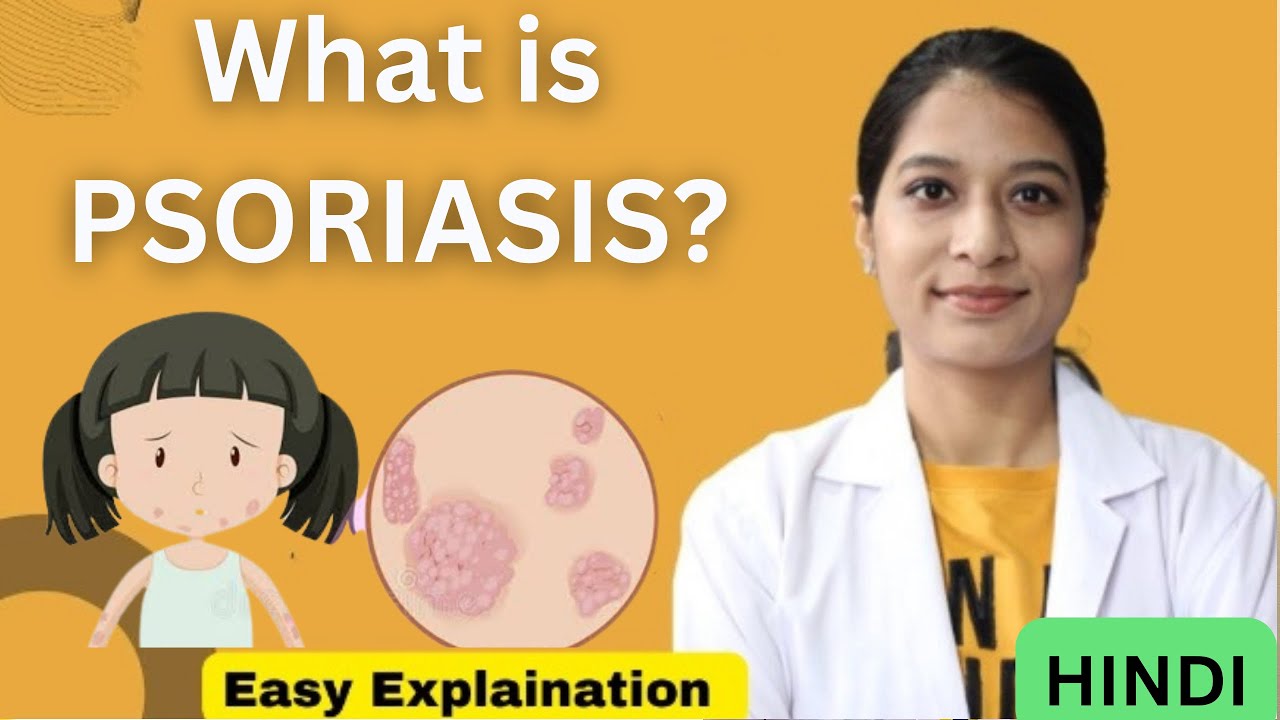 Psoriasis in Hindi Causes, Types, Symptoms, Pathology & Treatment