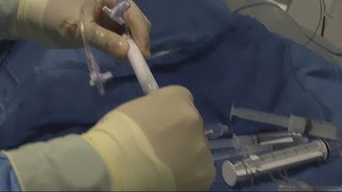 Groundbreaking blood clot procedure will save countless lives