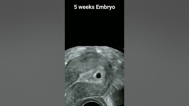 5 Weeks Pregnancy Ultrasound Scan | വയറ്റിലുള്ള കുഞ്ഞു 5 ആഴ്ചയിൽ #shorts #drsita