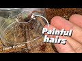 These TARANTULA HAIRS aren’t even itchy - THEY’RE PAINFUL !!!