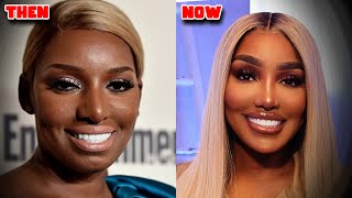 Real Housewives Who Completely Changed Their Face