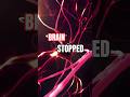 If Your Brain Stopped for 5 Seconds… Would You Survive?#whatif #shorts #viral