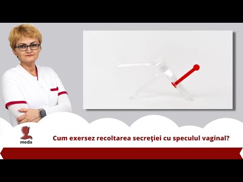 Video: Speculul Vaginal: Ce Trebuie Să știți