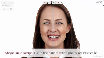 3Shape Smile Design - Excite the patient with photo-realism
