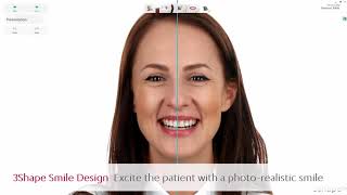 3Shape Smile Design - Excite the patient with photo-realism