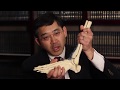 About Ankle Fusion from Dr. Chris Hirose