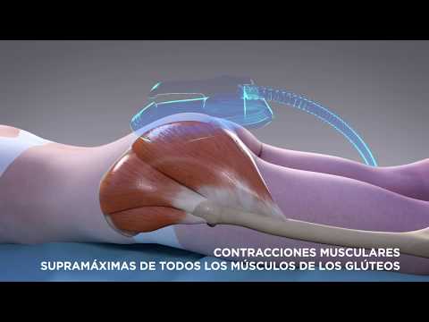 Vídeo: Els tractaments d'escultura corporal funcionen?