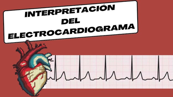Interpretacion Del Electrocardiograma Youtube