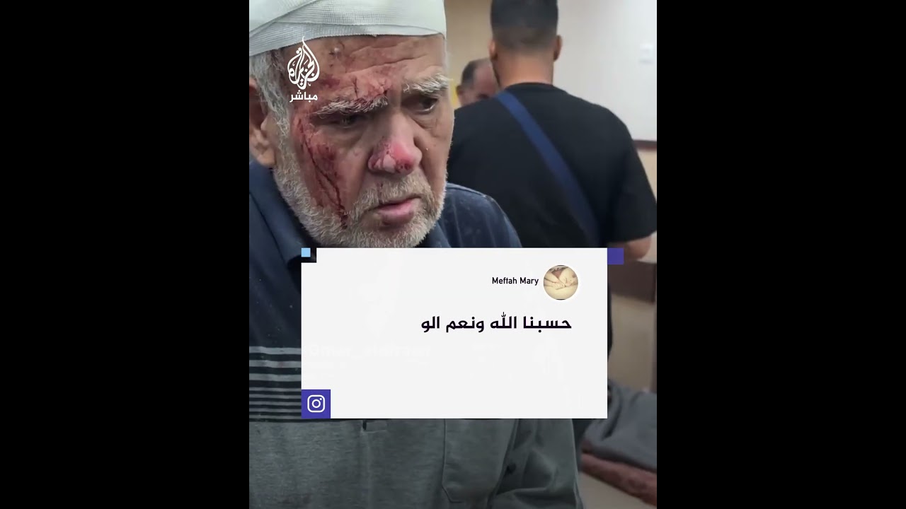 صدمة مسن فلسطيني عقب نجاته من غارة إسرائيلية ممـيتة على مخيم النصيرات وسط قطاع غزة