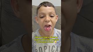 Desafio De Fazer O Trevo Com A Língua