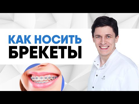 Как проходит лечение на брекетах? [ этапы лечения брекетами ].