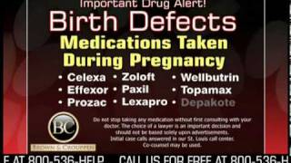 Birth Defects Injury Warning