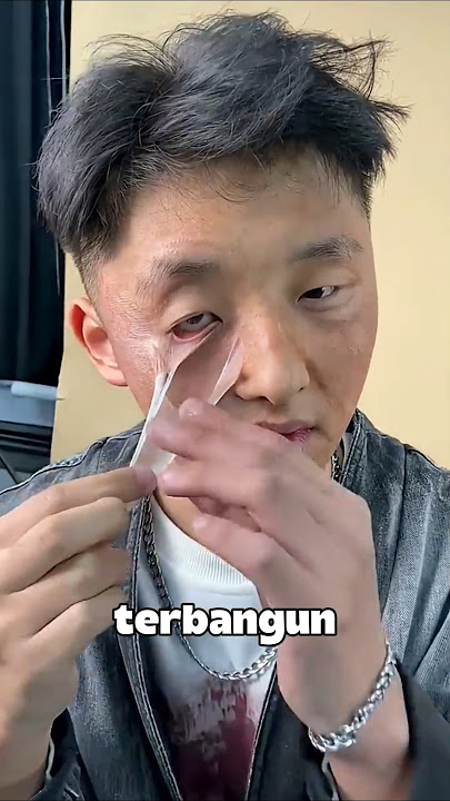 This guy was shocked after seeing the skin on his face #shorts #viralshorts