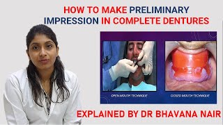 How to make preliminary impression in complete dentures