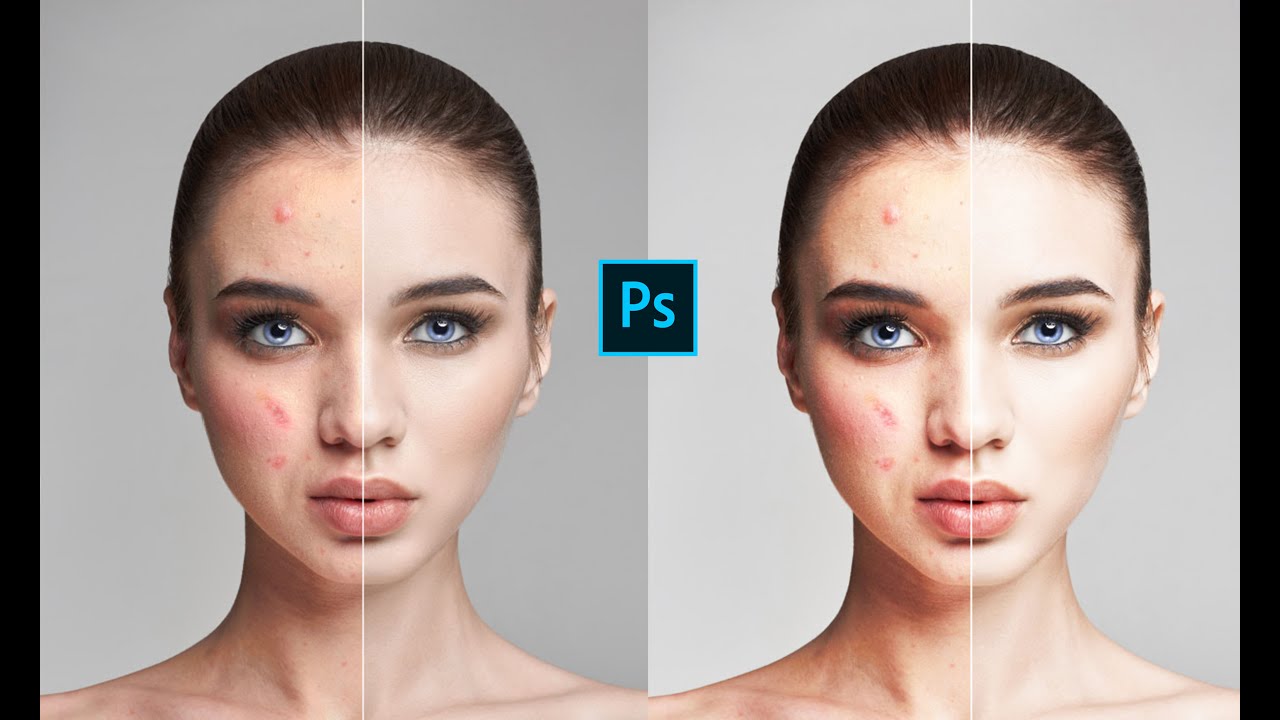 Pimples Acne Woman Face Before After In Photoshop Youtube