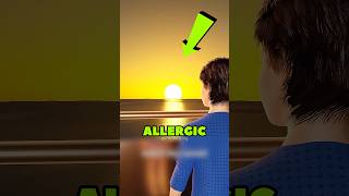 Can Sun Allergy Make You Burst Into Flames 🔥🌞