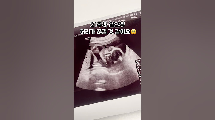 임신 21주차, 요통 구토 설사 쉽지 않네요 #임신중기 #임신브이로그 #임신기록