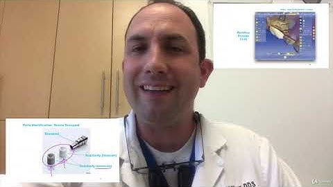 Restoring Dental Implants with CEREC and TiBase - learn Science