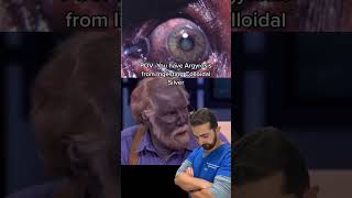 Pov You Have Argyrosis From Ingesting Colloidal Silver
