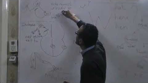 CVS Arrhythmia  2 Ectopic focus Dr Mohamed Fayez