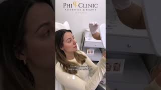✨ Botox in your 20s or 30s? Think prevention, not correction 💉🤎
