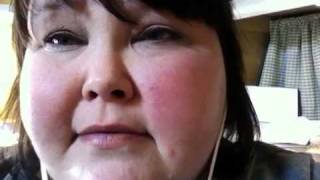 Lupus 1-3-11 a day in life with lupus vlog