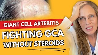 Non-Steroid Approaches to Giant Cell Arteritis: A New Hope for Patients