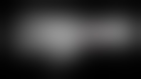 Palmar Approach for scaphoid bone