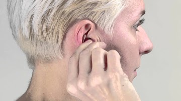 How to remove your ReSound Custom Microphone-In-Helix hearing instrument