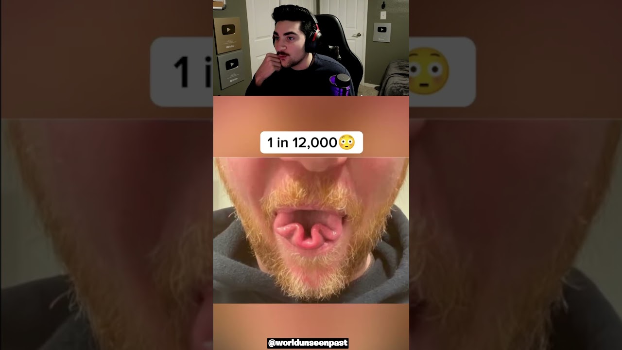 Редчайшая генетика человека! 😯