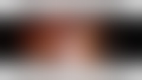 Troubleshooting Technique - Circular Stapler Won