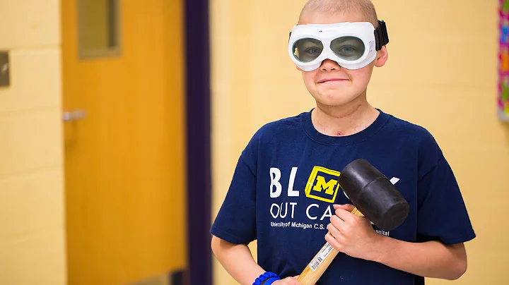 10-yr-old boy bashes 3D printed tumor "Boris"