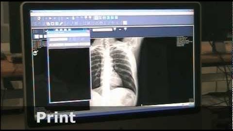 Cypher Workflow Video